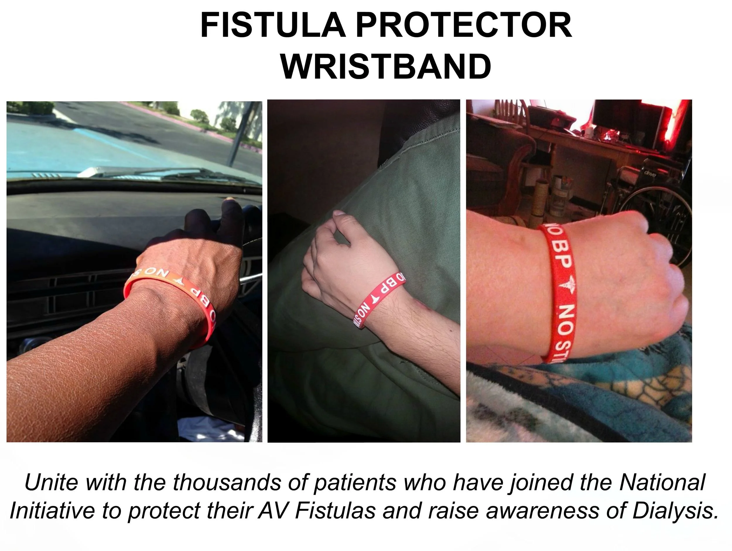 Dialysis fistula wristband online